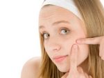 Прыщи на сухой коже лица: причины и уход